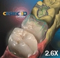 CEREC 3D, Version 2.6X